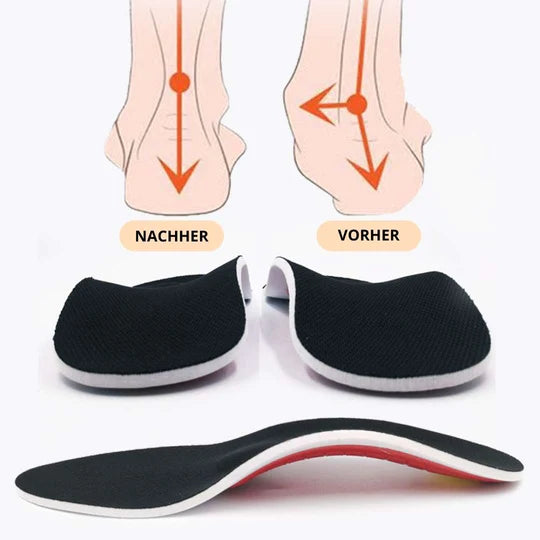 ArchEase™ - Orthopedic Insole Arch Support